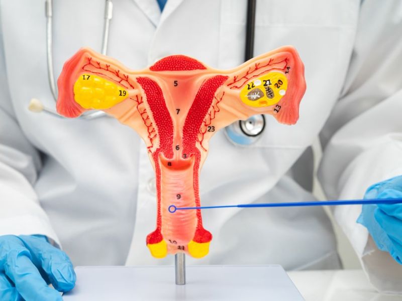 Prolasso vaginale: come prevenirlo e&nbsp;curarlo