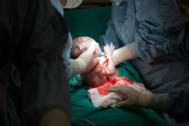 quando-e-necessario-fare-il-cesareo-secondo-le-linee-guida