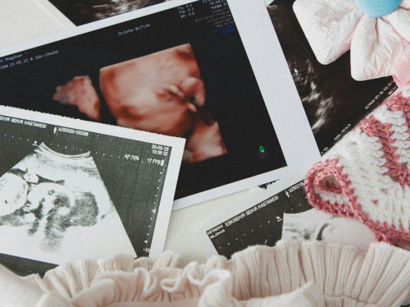 Linee guida aggiornate sulla gravidanza&nbsp;fisiologica